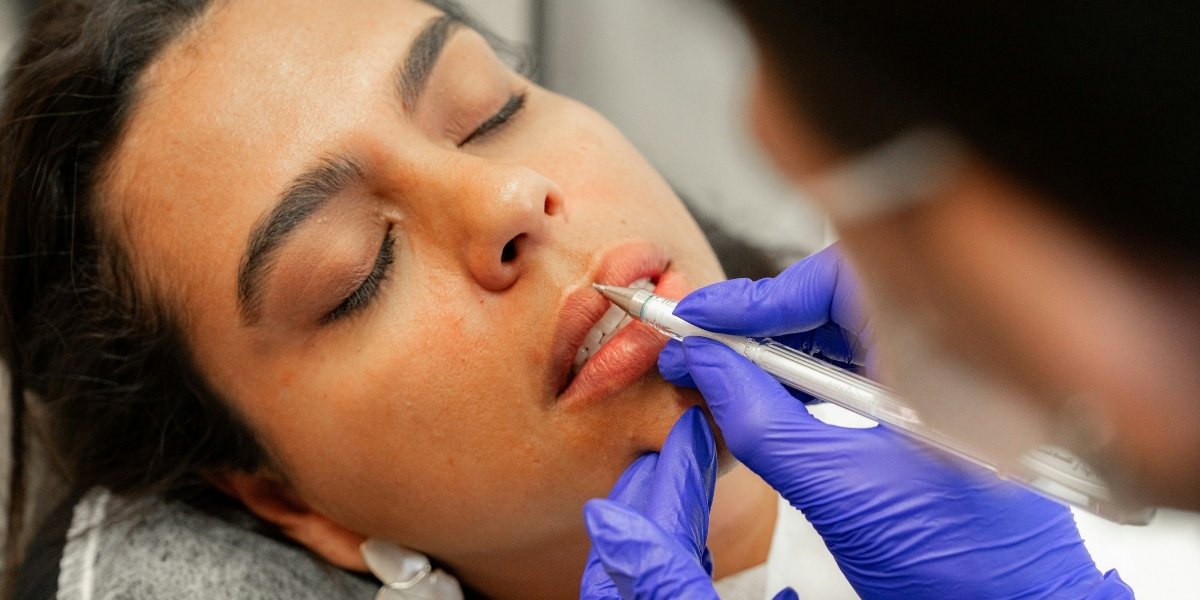 How to Achieve Natural-Looking Lip Enhancement with Fillers