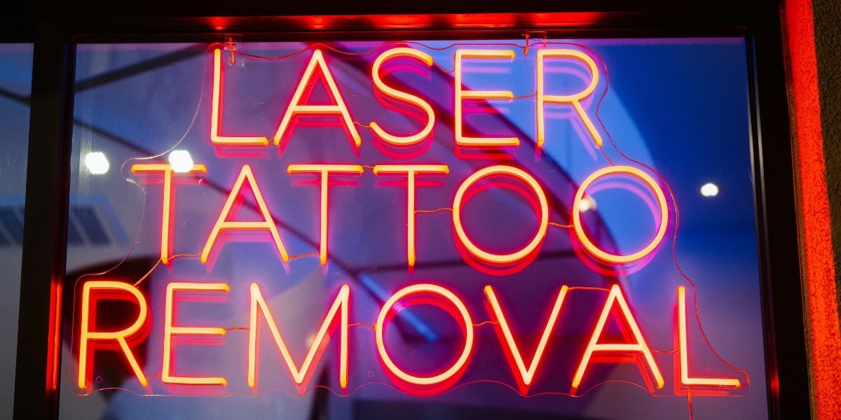 How Tattoo Removal Methods Affect Your Skin and Healing