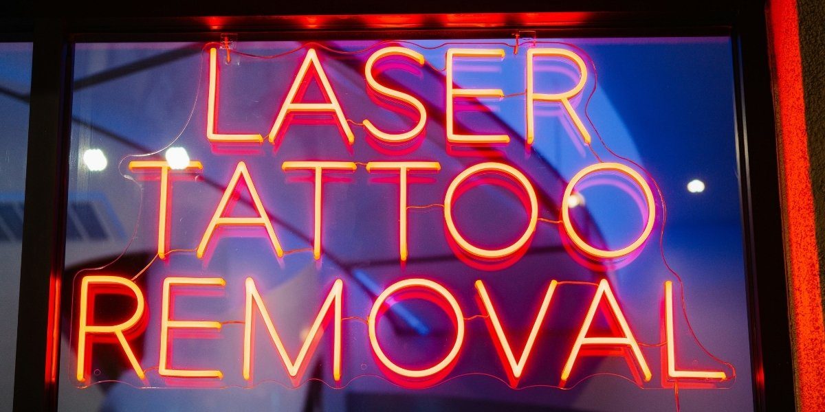 How Tattoo Removal Methods Affect Your Skin and Healing